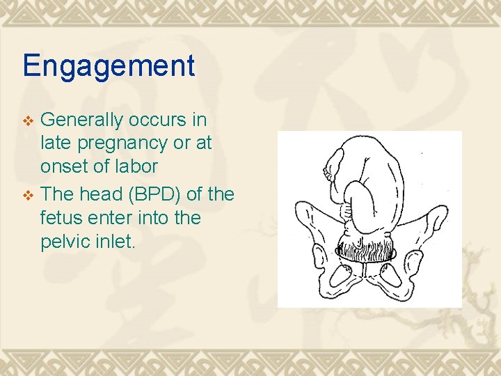 Engagement Generally occurs in late pregnancy or at onset of labor v The head