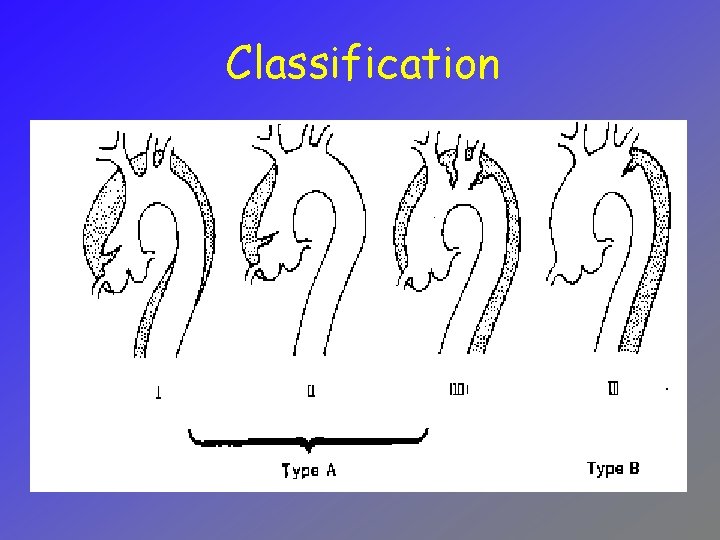 Classification 