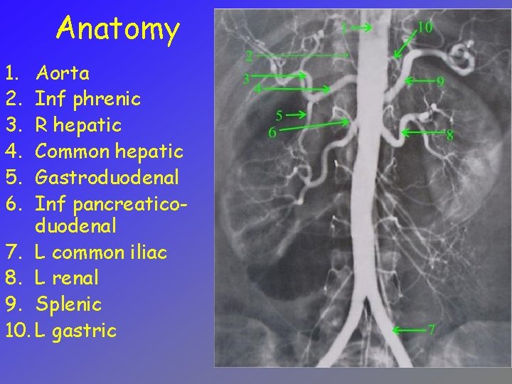 Anatomy 1. 2. 3. 4. 5. 6. Aorta Inf phrenic R hepatic Common hepatic