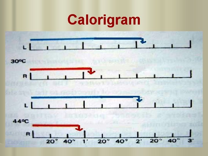 Calorigram 