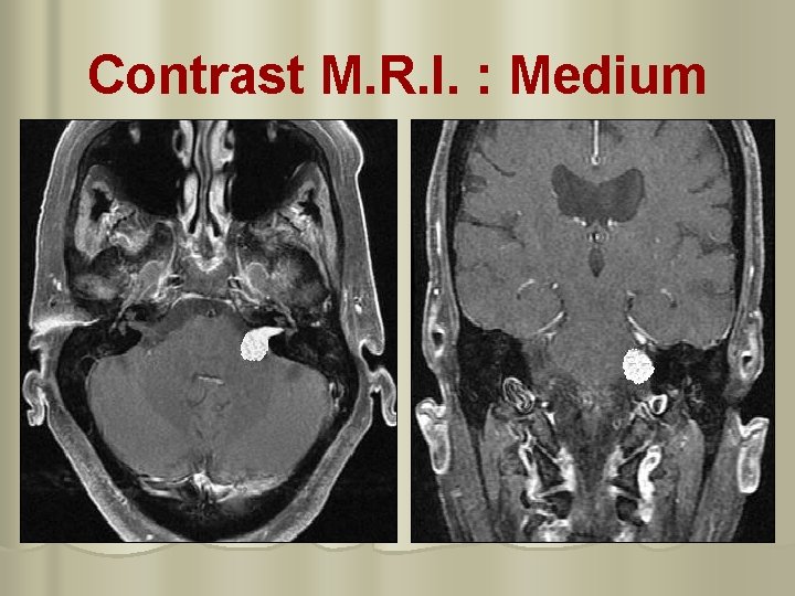 Contrast M. R. I. : Medium 