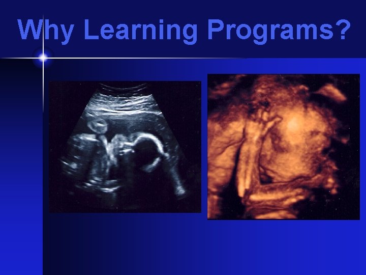 Why Learning Programs? 