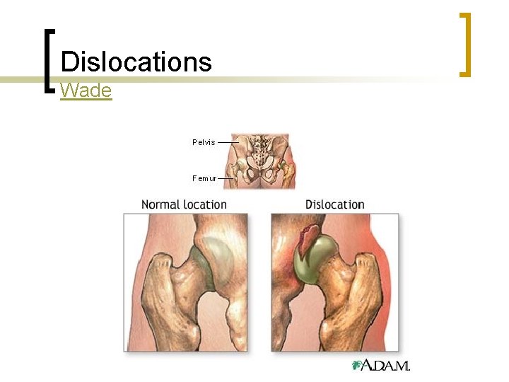 Dislocations Wade 