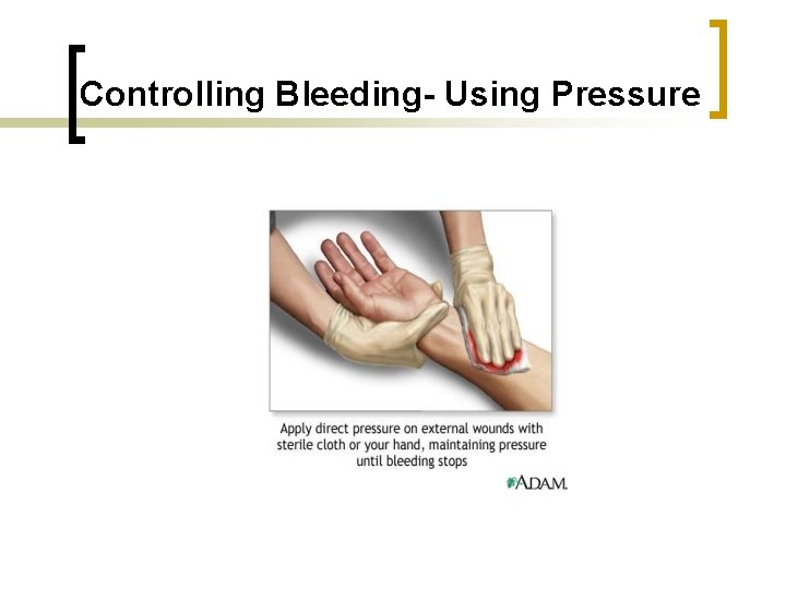 Controlling Bleeding- Using Pressure 