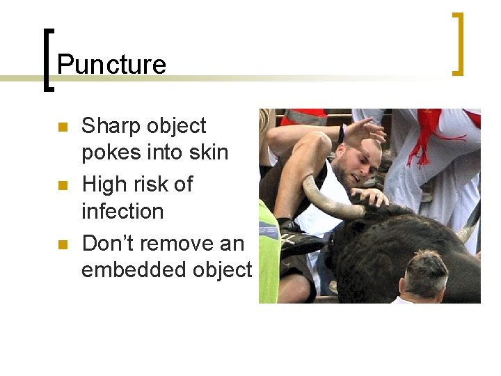 Puncture n n n Sharp object pokes into skin High risk of infection Don’t