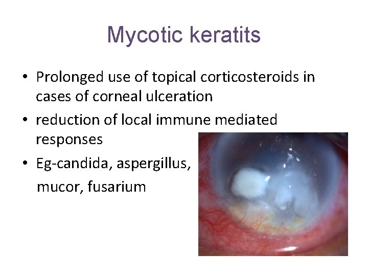 Mycotic keratits • Prolonged use of topical corticosteroids in cases of corneal ulceration •