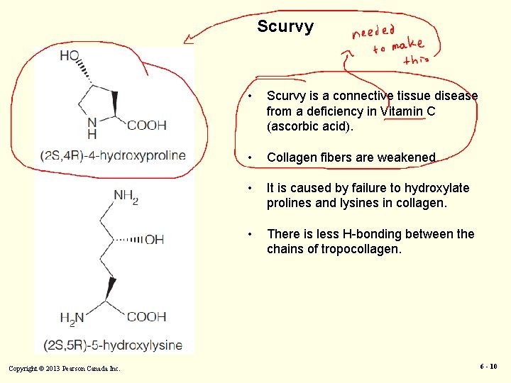 Scurvy Copyright © 2013 Pearson Canada Inc. • Scurvy is a connective tissue disease
