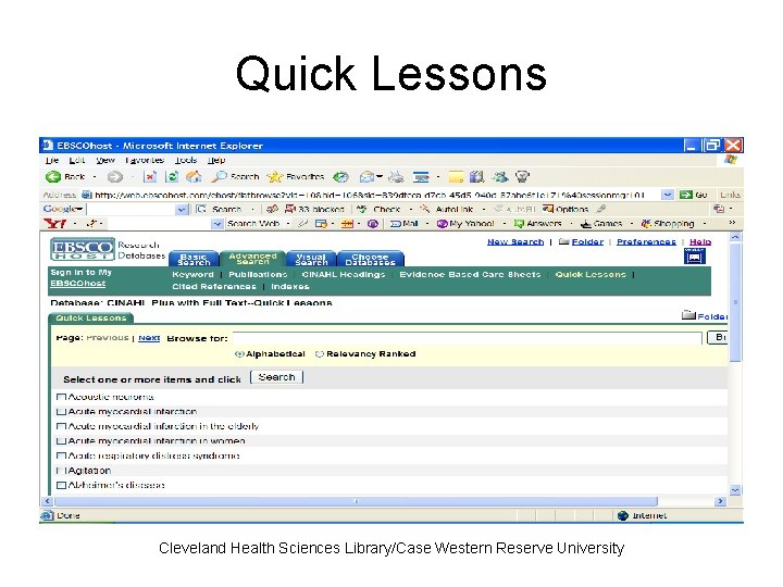 Quick Lessons Cleveland Health Sciences Library/Case Western Reserve University 
