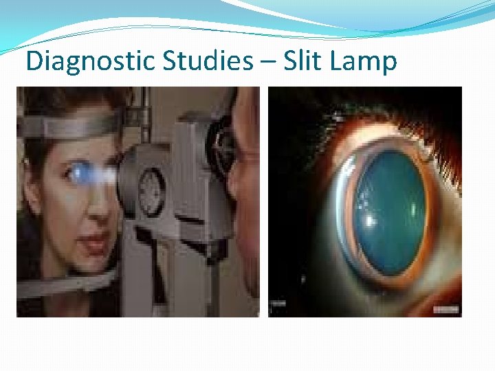 Diagnostic Studies – Slit Lamp 
