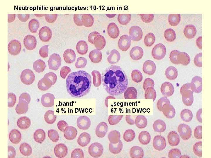 Neutrophilic granulocytes: 10 -12 m in „band“ 4 % in DWCC „segment“ 67 %