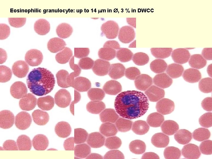 Eosinophilic granulocyte: up to 14 m in , 3 % in DWCC 