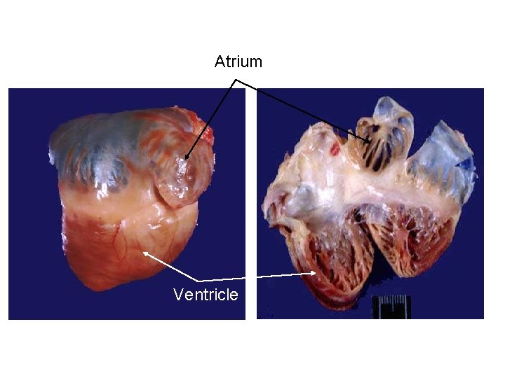 Atrium Ventricle 