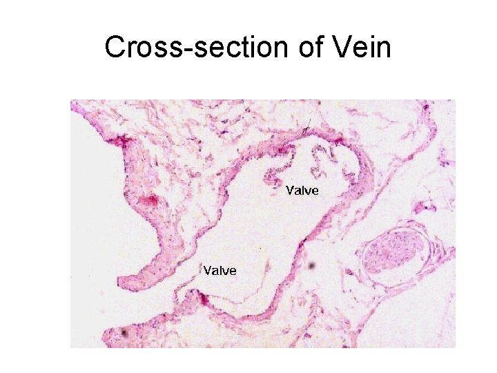 Cross-section of Vein 