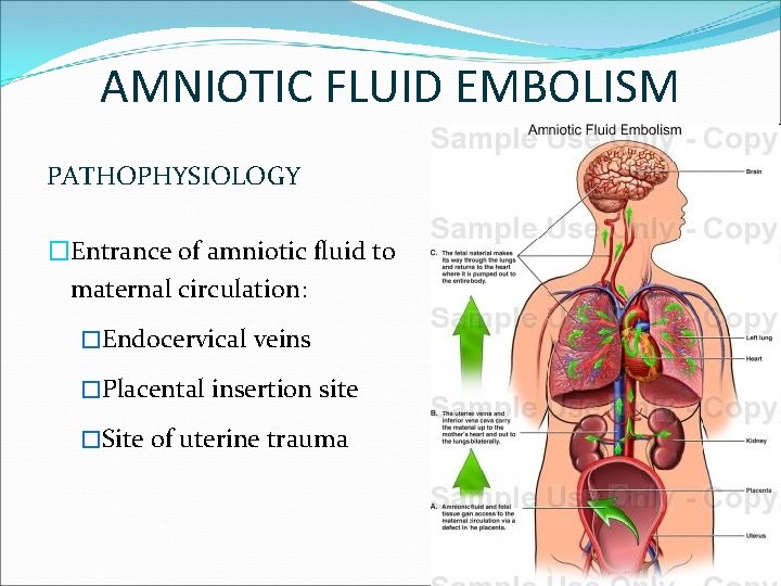 AMNIOTIC FLUID EMBOLISM PATHOPHYSIOLOGY �Entrance of amniotic fluid to maternal circulation: �Endocervical veins �Placental