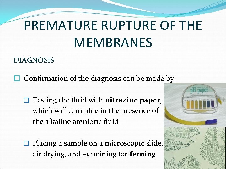 PREMATURE RUPTURE OF THE MEMBRANES DIAGNOSIS � Confirmation of the diagnosis can be made
