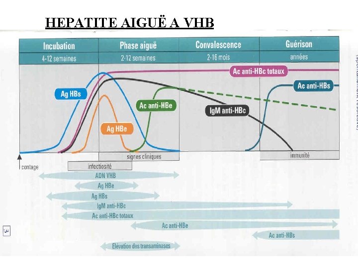 HEPATITE AIGUË A VHB 