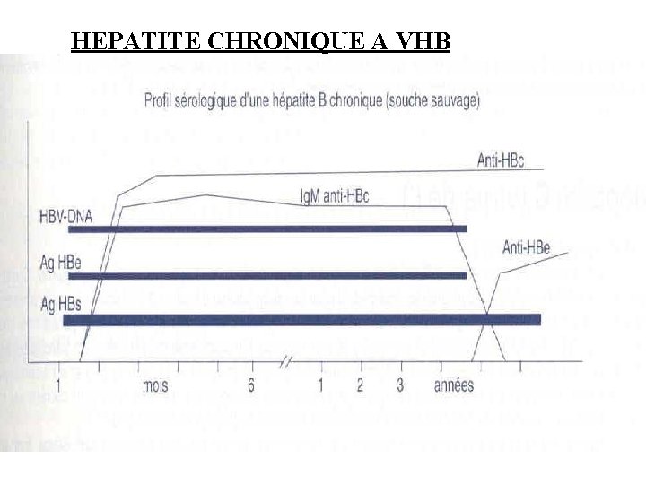 HEPATITE CHRONIQUE A VHB 