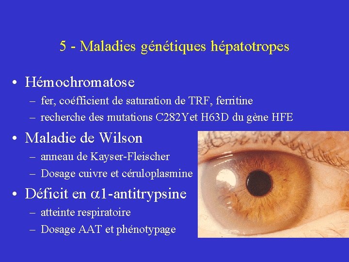 5 - Maladies génétiques hépatotropes • Hémochromatose – fer, coéfficient de saturation de TRF,