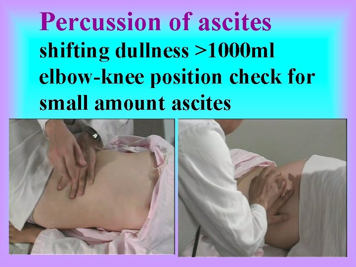 4 Palpation of masses the masses of abdomen