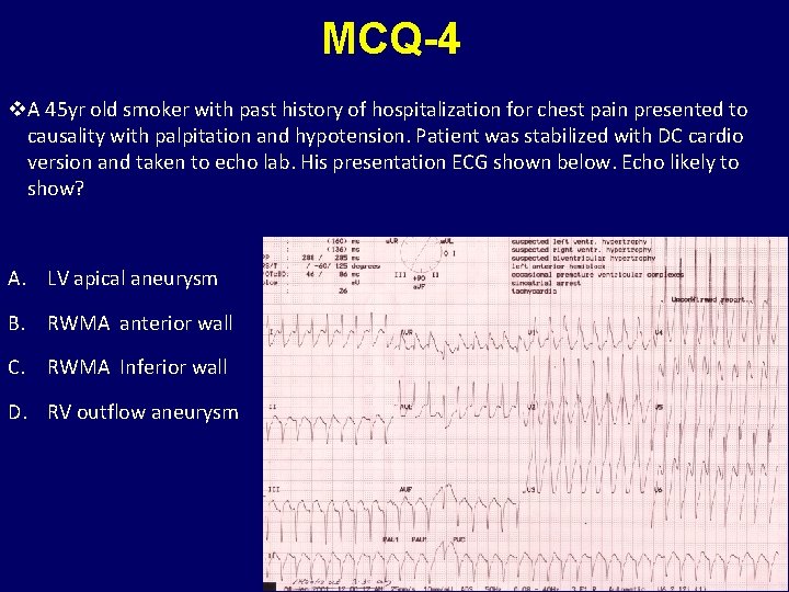 MCQ-4 v. A 45 yr old smoker with past history of hospitalization for chest