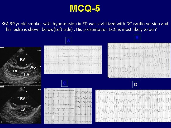 MCQ-5 v. A 39 yr old smoker with hypotension in ED was stabilized with