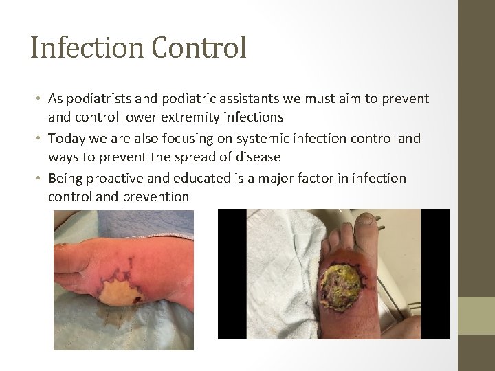 Infection Control • As podiatrists and podiatric assistants we must aim to prevent and