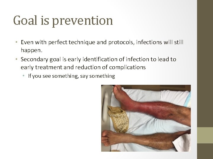 Goal is prevention • Even with perfect technique and protocols, infections will still happen.