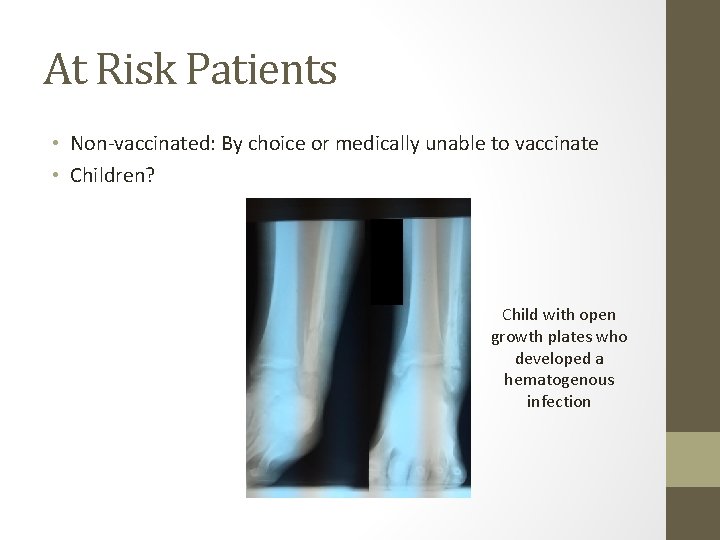 At Risk Patients • Non-vaccinated: By choice or medically unable to vaccinate • Children?