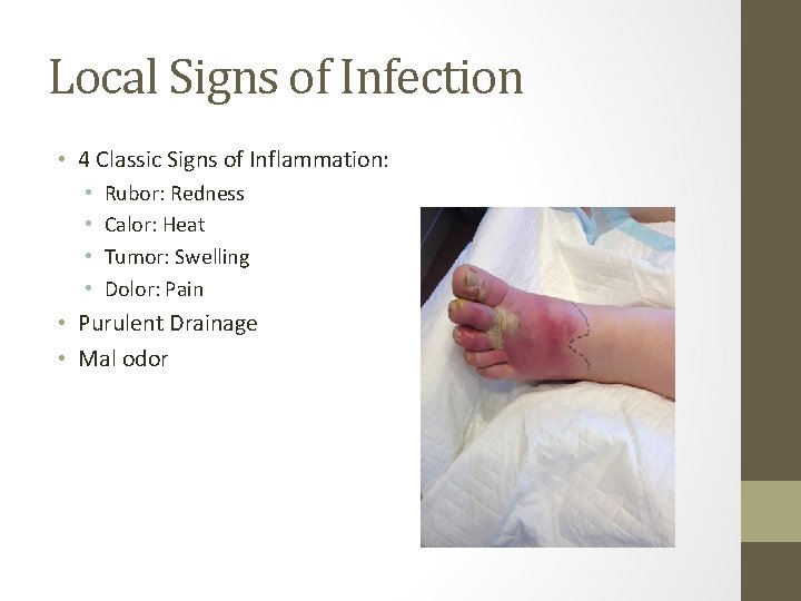 Local Signs of Infection • 4 Classic Signs of Inflammation: • • Rubor: Redness