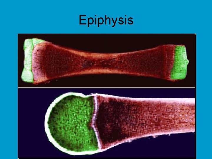 Epiphysis 