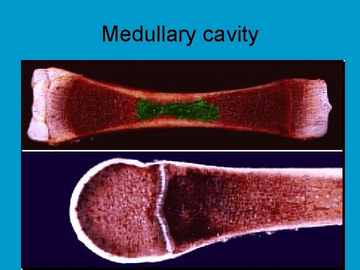 Medullary cavity 