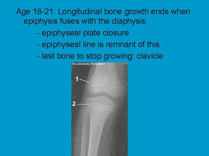 Age 18 -21: Longitudinal bone growth ends when epiphysis fuses with the diaphysis. -