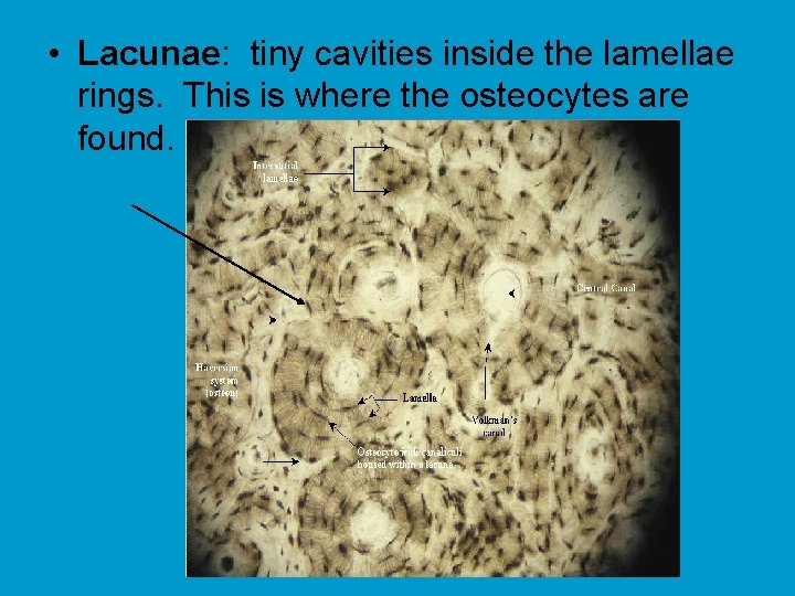  • Lacunae: tiny cavities inside the lamellae rings. This is where the osteocytes