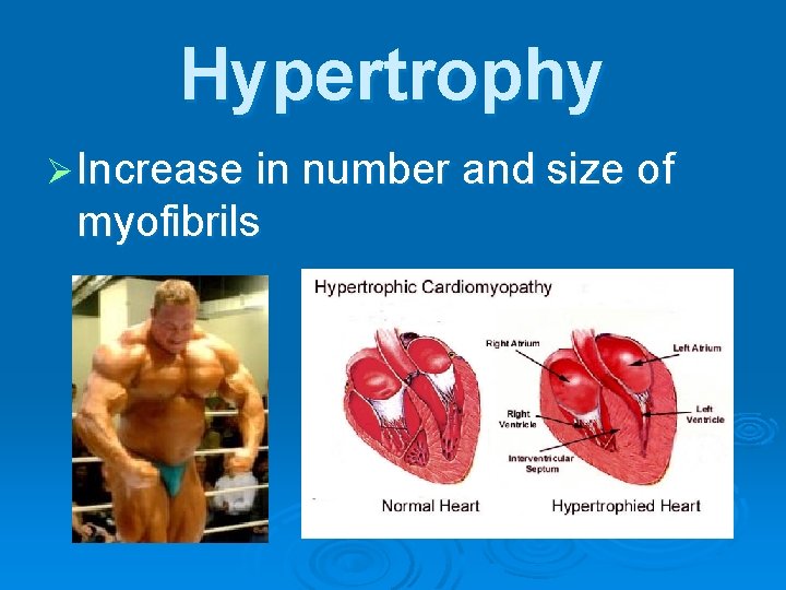 Hypertrophy Ø Increase in number and size of myofibrils 