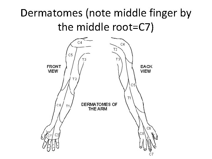 Dermatomes (note middle finger by the middle root=C 7) 