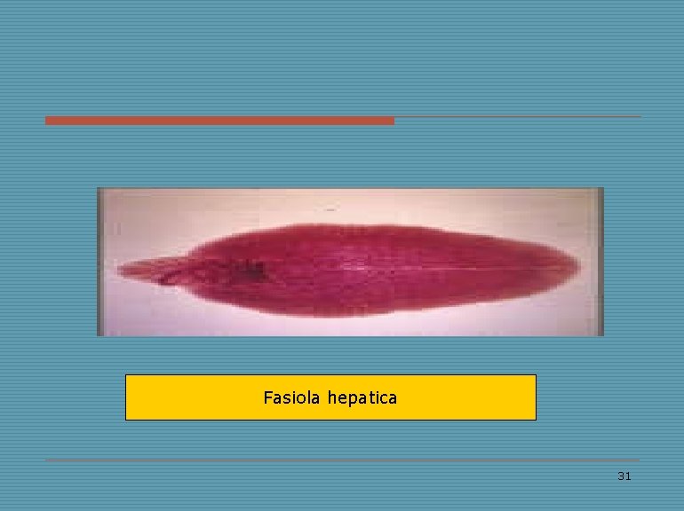 Fasiola hepatica 31 