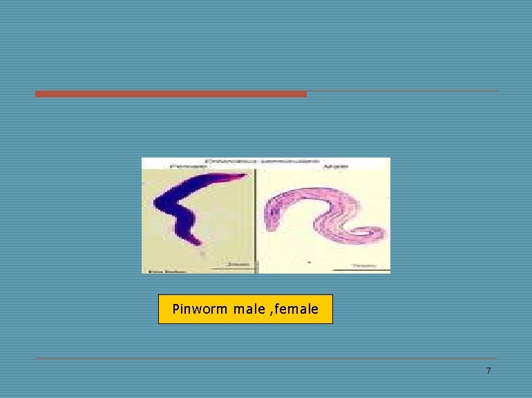 Pinworm male , female 7 