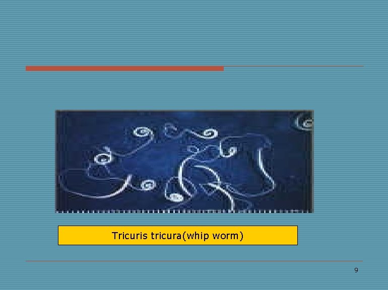 Tricuris tricura(whip worm) 9 