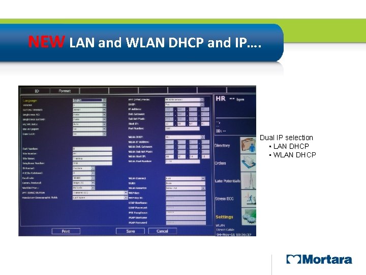 NEW LAN and WLAN DHCP and IP…. Dual IP selection • LAN DHCP •