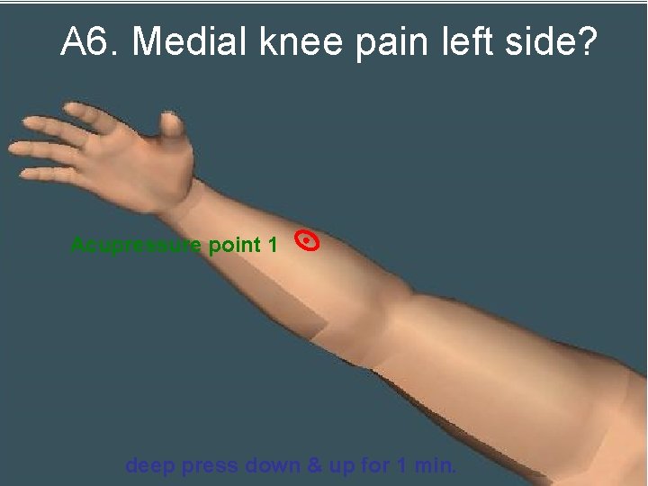 A 6. Medial knee pain left side? Acupressure point 1 deep press down &