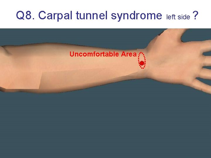 Q 8. Carpal tunnel syndrome Uncomfortable Area left side ? 