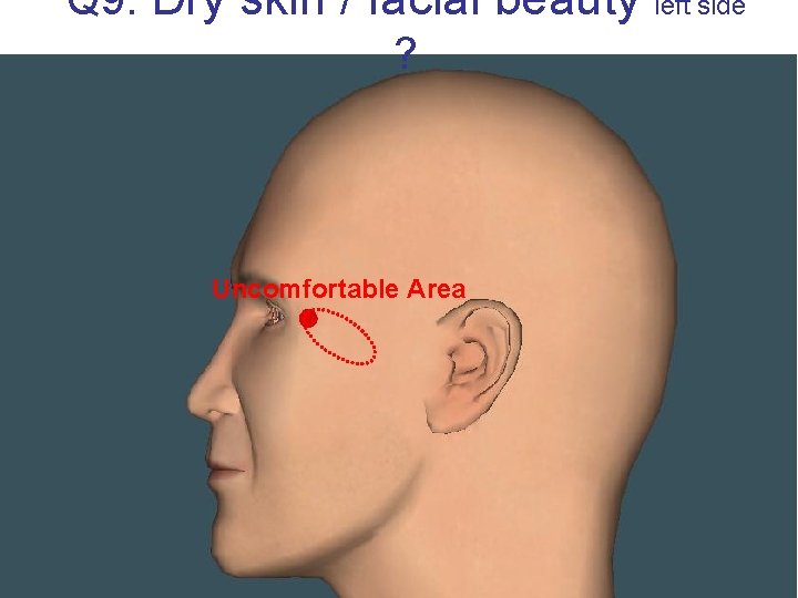 Q 9. Dry skin / facial beauty ? Uncomfortable Area left side 