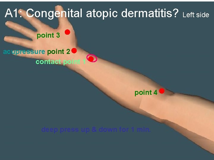 A 1: Congenital atopic dermatitis? Left side point 3 acupressure point 2 contact point