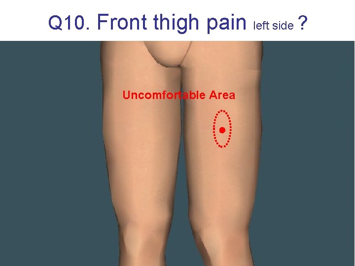 Q 10. Front thigh pain Uncomfortable Area left side ? 
