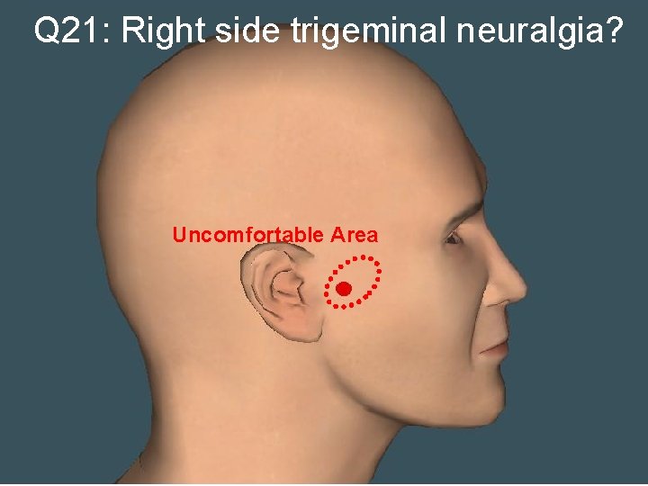 Q 21: Right side trigeminal neuralgia? Uncomfortable Area 