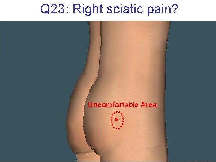 Q 23: Right sciatic pain? Uncomfortable Area 