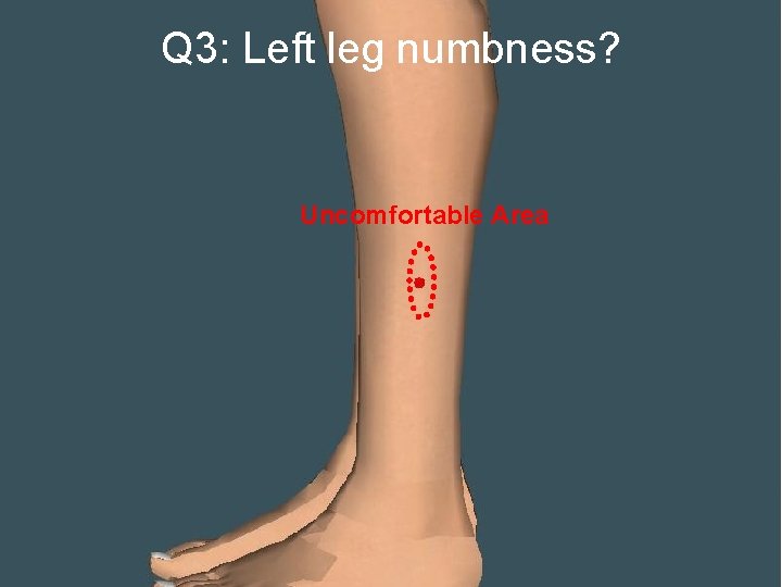 Q 3: Left leg numbness? Uncomfortable Area 