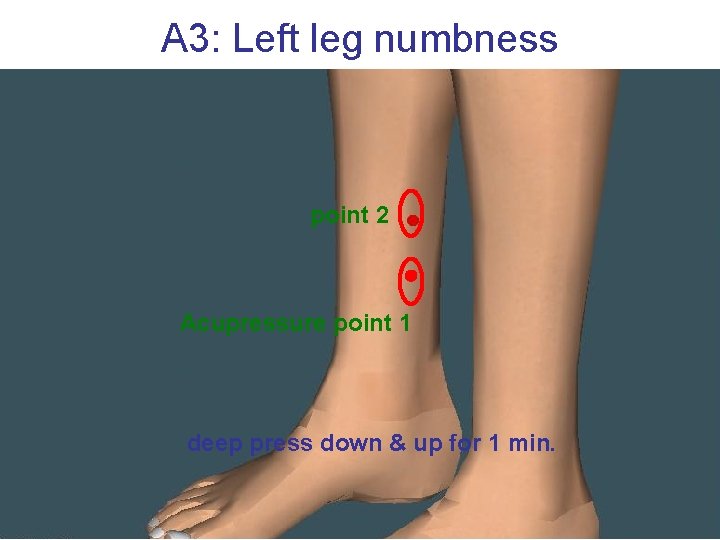 A 3: Left leg numbness point 2 Acupressure point 1 deep press down &