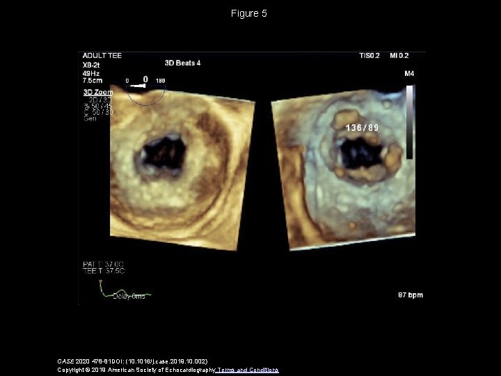 Figure 5 CASE 2020 478 -81 DOI: (10. 1016/j. case. 2019. 10. 002) Copyright