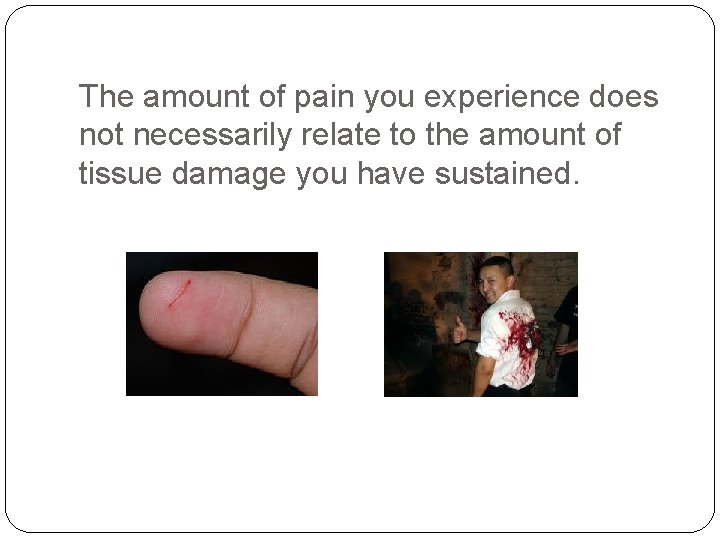 The amount of pain you experience does not necessarily relate to the amount of